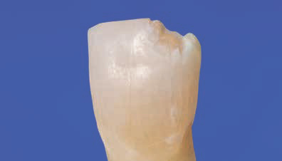 Ecusphere Shape A2 - сломанный режущий край